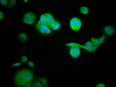 RASAL1 / RASAL Antibody - Immunofluorescence staining of MCF-7 cells at a dilution of 1:105, counter-stained with DAPI. The cells were fixed in 4% formaldehyde, permeabilized using 0.2% Triton X-100 and blocked in 10% normal Goat Serum. The cells were then incubated with the antibody overnight at 4 °C.The secondary antibody was Alexa Fluor 488-congugated AffiniPure Goat Anti-Rabbit IgG (H+L) .
