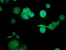 RASAL1 / RASAL Antibody - Immunofluorescence staining of MCF-7 cells at a dilution of 1:105, counter-stained with DAPI. The cells were fixed in 4% formaldehyde, permeabilized using 0.2% Triton X-100 and blocked in 10% normal Goat Serum. The cells were then incubated with the antibody overnight at 4 °C.The secondary antibody was Alexa Fluor 488-congugated AffiniPure Goat Anti-Rabbit IgG (H+L) .