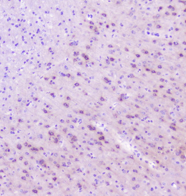 RASAL1 / RASAL Antibody - IHC analysis of RASAL1 using anti-RASAL1 antibody. RASAL1 was detected in paraffin-embedded section of mouse brain tissue. Heat mediated antigen retrieval was performed in citrate buffer (pH6, epitope retrieval solution) for 20 mins. The tissue section was blocked with 10% goat serum. The tissue section was then incubated with 1µg/ml rabbit anti-RASAL1 Antibody overnight at 4°C. Biotinylated goat anti-rabbit IgG was used as secondary antibody and incubated for 30 minutes at 37°C. The tissue section was developed using Strepavidin-Biotin-Complex (SABC) with DAB as the chromogen.