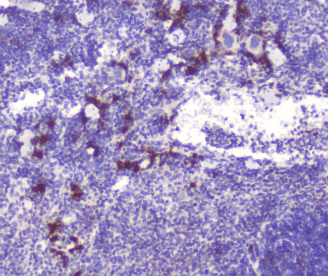 RASAL1 / RASAL Antibody - IHC analysis of RASAL1 using anti-RASAL1 antibody. RASAL1 was detected in paraffin-embedded section of mouse spleen tissue. Heat mediated antigen retrieval was performed in citrate buffer (pH6, epitope retrieval solution) for 20 mins. The tissue section was blocked with 10% goat serum. The tissue section was then incubated with 1µg/ml rabbit anti-RASAL1 Antibody overnight at 4°C. Biotinylated goat anti-rabbit IgG was used as secondary antibody and incubated for 30 minutes at 37°C. The tissue section was developed using Strepavidin-Biotin-Complex (SABC) with DAB as the chromogen.