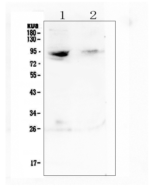 RASAL1 / RASAL Antibody - Western blot analysis of RASAL1 using anti-RASAL1 antibody. Electrophoresis was performed on a 5-20% SDS-PAGE gel at 70V (Stacking gel) / 90V (Resolving gel) for 2-3 hours. The sample well of each lane was loaded with 50ug of sample under reducing conditions. Lane 1: human MDA-MB-231 whole cell lysate,Lane 2: human Jurkat whole cell lysate. After Electrophoresis, proteins were transferred to a Nitrocellulose membrane at 150mA for 50-90 minutes. Blocked the membrane with 5% Non-fat Milk/ TBS for 1.5 hour at RT. The membrane was incubated with rabbit anti-RASAL1 antigen affinity purified polyclonal antibody at 0.5 µg/mL overnight at 4°C, then washed with TBS-0.1% Tween 3 times with 5 minutes each and probed with a goat anti-rabbit IgG-HRP secondary antibody at a dilution of 1:10000 for 1.5 hour at RT. The signal is developed using an Enhanced Chemiluminescent detection (ECL) kit with Tanon 5200 system. A specific band was detected for RASAL1 at approximately 90KD. The expected band size for RASAL1 is at 90KD.