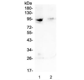 RASAL1 / RASAL Antibody - Western blot testing of human 1) MDA-MB-231 and 2) Jurkat lysate with RASAL1 antibody at 0.5ug/ml. Predicted molecular weight ~90 kDa.
