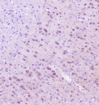RASAL1 / RASAL Antibody - IHC staining of FFPE mouse brain with RASAL1 antibody at 1ug/ml. HIER: boil tissue sections in pH6, 10mM citrate buffer, for 10-20 min followed by cooling at RT for 20 min.