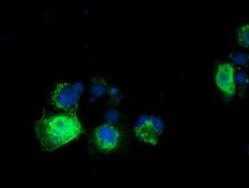RASD2 Antibody - Anti-RASD2 mouse monoclonal antibody  immunofluorescent staining of COS7 cells transiently transfected by pCMV6-ENTRY RASD2.
