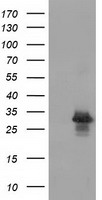 RASD2 Antibody - HEK293T cells were transfected with the pCMV6-ENTRY control (Left lane) or pCMV6-ENTRY RASD2 (Right lane) cDNA for 48 hrs and lysed. Equivalent amounts of cell lysates (5 ug per lane) were separated by SDS-PAGE and immunoblotted with anti-RASD2.