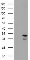 RASD2 Antibody - HEK293T cells were transfected with the pCMV6-ENTRY control (Left lane) or pCMV6-ENTRY RASD2 (Right lane) cDNA for 48 hrs and lysed. Equivalent amounts of cell lysates (5 ug per lane) were separated by SDS-PAGE and immunoblotted with anti-RASD2.
