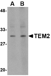 RASD2 Antibody - Western blot of TEM2 in human colon tissue lysate with TEM2 antibody at (A) 1 and (B) 2 ug/ml. Below: Immunohistochemistry of TEM2 in human colon tissue with TEM2 antibody at 2.5 ug/ml.