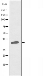 RASD2 Antibody - Western blot analysis of extracts of Jurkat cells using RASD2 antibody.
