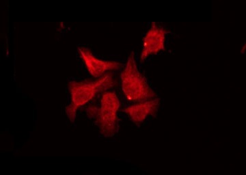 RASD2 Antibody - Staining HeLa cells by IF/ICC. The samples were fixed with PFA and permeabilized in 0.1% Triton X-100, then blocked in 10% serum for 45 min at 25°C. The primary antibody was diluted at 1:200 and incubated with the sample for 1 hour at 37°C. An Alexa Fluor 594 conjugated goat anti-rabbit IgG (H+L) Ab, diluted at 1/600, was used as the secondary antibody.