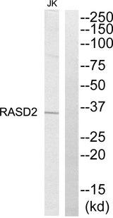 RASD2 Antibody - Western blot analysis of extracts from Jurkat cells, using RASD2 antibody.