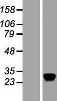 RASD2 Protein - Western validation with an anti-DDK antibody * L: Control HEK293 lysate R: Over-expression lysate