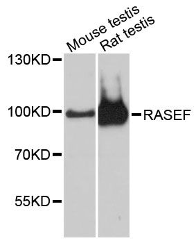 RASEF Antibody - Western blot analysis of extracts of various cell lines, using RASEF antibody at 1:3000 dilution. The secondary antibody used was an HRP Goat Anti-Rabbit IgG (H+L) at 1:10000 dilution. Lysates were loaded 25ug per lane and 3% nonfat dry milk in TBST was used for blocking. An ECL Kit was used for detection and the exposure time was 30s.