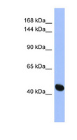 RASGRF1 / CDC25 Antibody - RASGRF1 antibody Western blot of HepG2 cell lysate. This image was taken for the unconjugated form of this product. Other forms have not been tested.