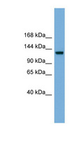 RASGRF1 / CDC25 Antibody - RASGRF1 antibody Western blot of Fetal Brain lysate. This image was taken for the unconjugated form of this product. Other forms have not been tested.