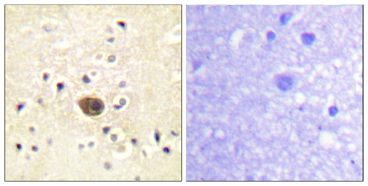 RASGRF1 / CDC25 Antibody - Immunohistochemistry analysis of paraffin-embedded human brain tissue, using Ras-GRF1 Antibody. The picture on the right is blocked with the synthesized peptide.