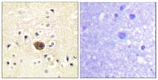RASGRF1 / CDC25 Antibody - Peptide - + Immunohistochemistry analysis of paraffin-embedded human brain tissue using Ras-GRF1 antibody.