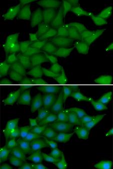 RASGRF1 / CDC25 Antibody - Immunofluorescence analysis of U20S cells.