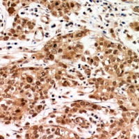 RASGRF1 / CDC25 Antibody