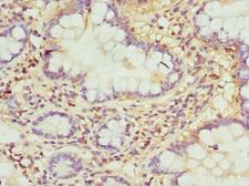 RASGRF1 / CDC25 Antibody - Immunohistochemistry of paraffin-embedded human small intestine at dilution 1:100