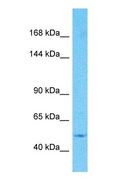 RASGRF1 / CDC25 Antibody - Western blot of RASGRF1 Antibody with human 786-0 Whole Cell lysate.  This image was taken for the unconjugated form of this product. Other forms have not been tested.