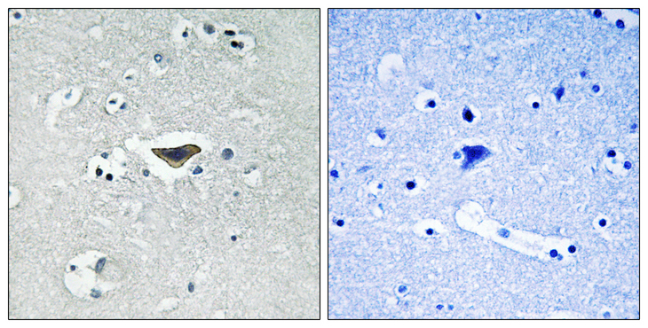 RASGRF1 / CDC25 Antibody - Immunohistochemistry analysis of paraffin-embedded human brain, using Ras-GRF1 (Phospho-Ser916) Antibody. The picture on the right is blocked with the phospho peptide.
