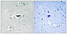 RASGRF1 / CDC25 Antibody - Immunohistochemistry analysis of paraffin-embedded human brain, using Ras-GRF1 (Phospho-Ser916) Antibody. The picture on the right is blocked with the phospho peptide.