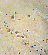 RASGRP1 / RASGRP Antibody - RASGRP1 Antibody immunohistochemistry of formalin-fixed and paraffin-embedded human brain tissue followed by peroxidase-conjugated secondary antibody and DAB staining.