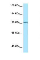 RASGRP1 / RASGRP Antibody - RASGRP1 antibody Western blot of Jurkat Cell lysate. Antibody concentration 1 ug/ml.  This image was taken for the unconjugated form of this product. Other forms have not been tested.