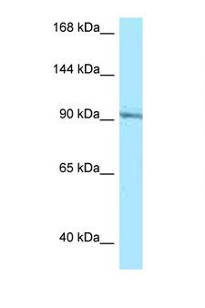 RASGRP1 / RASGRP Antibody - RASGRP1 antibody Western blot of Jurkat Cell lysate. Antibody concentration 1 ug/ml.  This image was taken for the unconjugated form of this product. Other forms have not been tested.