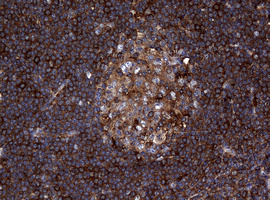RASGRP3 / GRP3 Antibody - IHC of paraffin-embedded Human tonsil using anti-RASGRP3 mouse monoclonal antibody. (Heat-induced epitope retrieval by 10mM citric buffer, pH6.0, 120°C for 3min).