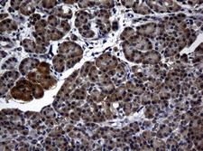 RASGRP3 / GRP3 Antibody - IHC of paraffin-embedded Human pancreas tissue using anti-RASGRP3 mouse monoclonal antibody.