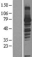 RASGRP3 / GRP3 Protein - Western validation with an anti-DDK antibody * L: Control HEK293 lysate R: Over-expression lysate