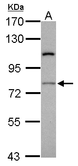 RASGRP4 Antibody - Sample (30 ug of whole cell lysate). A: Jurkat. 7.5% SDS PAGE. RASGRP4 antibody diluted at 1:1000.