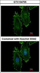 RASGRP4 Antibody - Immunofluorescence of methanol-fixed HeLa using RASGRP4 antibody at 1:500 dilution.