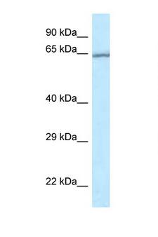 RASGRP4 Antibody - RASGRP4 antibody Western blot of Jurkat Cell lysate. Antibody concentration 1 ug/ml.  This image was taken for the unconjugated form of this product. Other forms have not been tested.