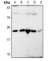 RASL10B Antibody - Western blot analysis of RASL10B expression in A549 (A), LOVO (B), SP20 (C), PMVEC (D), Hela (E) whole cell lysates.