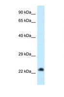 RASL11B Antibody - RASL11B antibody Western blot of HeLa Cell lysate. Antibody concentration 1 ug/ml.  This image was taken for the unconjugated form of this product. Other forms have not been tested.