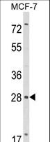 RASL11B Antibody - Western blot of RASL11B Antibody in MCF-7 cell line lysates (35 ug/lane). RASL11B (arrow) was detected using the purified antibody.