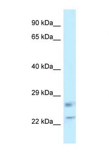 RASL11B Antibody - RASL11B antibody Western blot of Placenta lysate. Antibody concentration 1 ug/ml.  This image was taken for the unconjugated form of this product. Other forms have not been tested.
