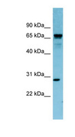 RASL12 Antibody - RASL12 antibody Western blot of MCF7 cell lysate. This image was taken for the unconjugated form of this product. Other forms have not been tested.