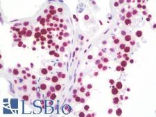 RASSF1 / RASSF1A Antibody - Anti-RASSF1 / RASSF1A antibody IHC staining of human testis. Immunohistochemistry of formalin-fixed, paraffin-embedded tissue after heat-induced antigen retrieval. Antibody concentration 10 ug/ml.