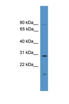 RASSF1 / RASSF1A Antibody - RASSF1 / RASSF1A antibody Western blot of Fetal Lung lysate. Antibody concentration 1 ug/ml.  This image was taken for the unconjugated form of this product. Other forms have not been tested.