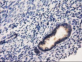 RASSF1 / RASSF1A Antibody - IHC of paraffin-embedded Human endometrium tissue using anti-RASSF1 mouse monoclonal antibody. (Heat-induced epitope retrieval by 10mM citric buffer, pH6.0, 100C for 10min).