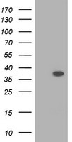 RASSF1 / RASSF1A Antibody - HEK293T cells were transfected with the pCMV6-ENTRY control (Left lane) or pCMV6-ENTRY RASSF1 (Right lane) cDNA for 48 hrs and lysed. Equivalent amounts of cell lysates (5 ug per lane) were separated by SDS-PAGE and immunoblotted with anti-RASSF1.