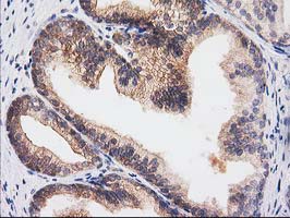 RASSF1 / RASSF1A Antibody - IHC of paraffin-embedded Human prostate tissue using anti-RASSF1 mouse monoclonal antibody. (Heat-induced epitope retrieval by 10mM citric buffer, pH6.0, 100C for 10min).