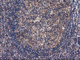 RASSF1 / RASSF1A Antibody - IHC of paraffin-embedded Human lymph node tissue using anti-RASSF1 mouse monoclonal antibody. (Heat-induced epitope retrieval by 10mM citric buffer, pH6.0, 100C for 10min).
