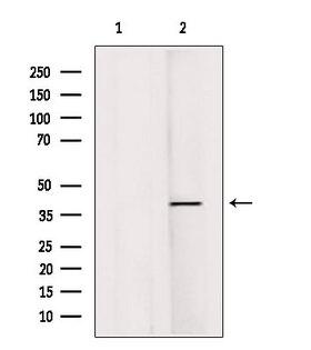 RASSF1 / RASSF1A Antibody - Western blot analysis of extracts of HeLa cells using RASSF1 antibody. Lane 1 was treated with the antigen-specific peptide.