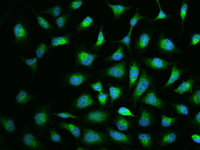 RASSF1 / RASSF1A Antibody - Immunofluorescence staining of RASSF1 in Hela cells. Cells were fixed with 4% PFA, permeabilzed with 0.1% Triton X-100 in PBS, blocked with 10% serum, and incubated with rabbit anti-Human RASSF1 polyclonal antibody (dilution ratio 1:200) at 4°C overnight. Then cells were stained with the Alexa Fluor 488-conjugated Goat Anti-rabbit IgG secondary antibody (green) and counterstained with DAPI (blue). Positive staining was localized to Cytoplasm.