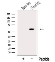 RASSF10 Antibody - Western blot analysis of extracts of HepG2 cells using RASFA antibody. The lane on the left was treated with blocking peptide.