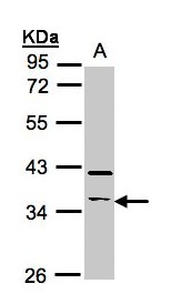 RASSF2 Antibody - Sample (30 ug whole cell lysate). A: Raji . 10% SDS PAGE. RASSF2 antibody diluted at 1:500